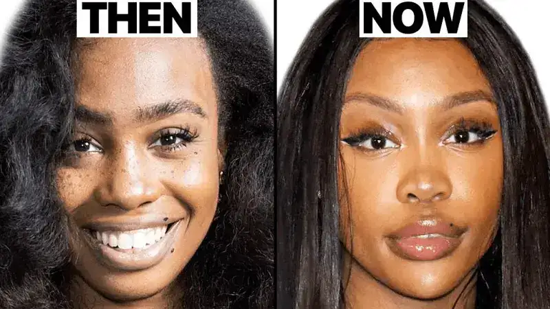 SZA Before Surgery